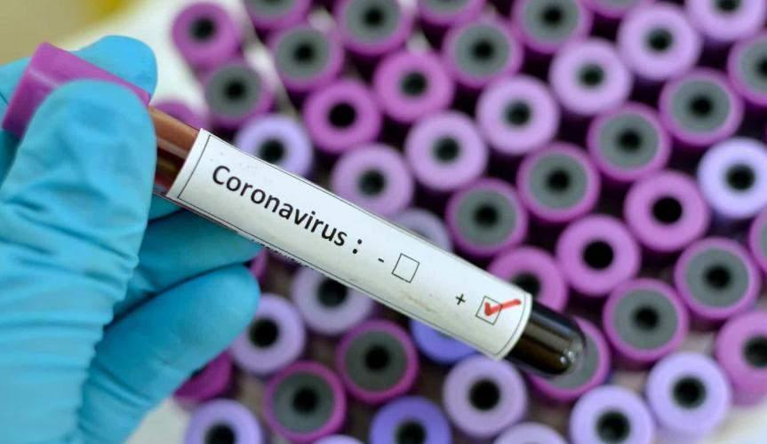 Espírito Santo registra mais 13 casos do novo coronavírus; número já passa de 80 infectados