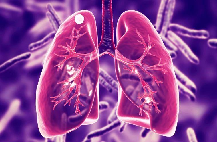 Doença Pulmonar Obstrutiva Crônica é a quarta causa de morte da população brasileira