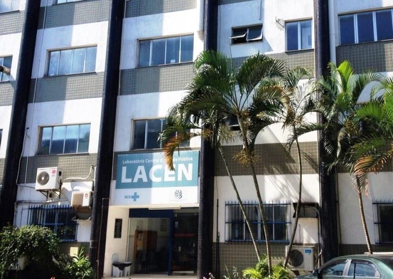 Lacen/ES realiza em três meses o equivalente a 20 anos de rotina de testagem