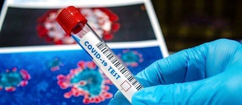 ES tem 21.964 casos confirmados do novo coronavírus e 11.892 pacientes curados da doença