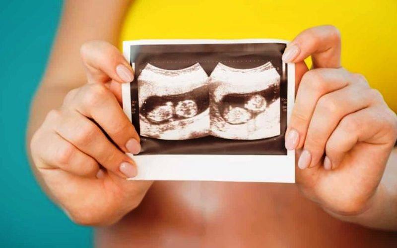 Mulher com dois úteros carrega gêmeos gestados separadamente