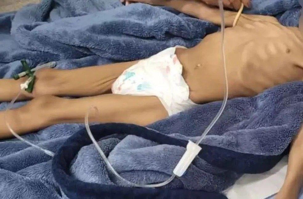 Pai é preso após deixar filha de 3 anos sem comida por 40 dias