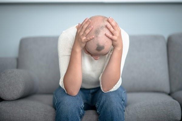 Alopecia areata: Anvisa libera remédio para grave queda de cabelo