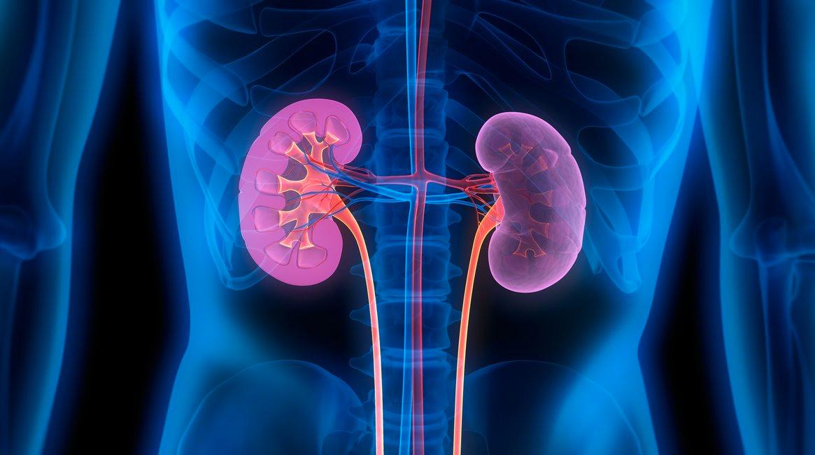 Quando um nódulo nos rins é preocupante? 6 fatos sobre o câncer renal