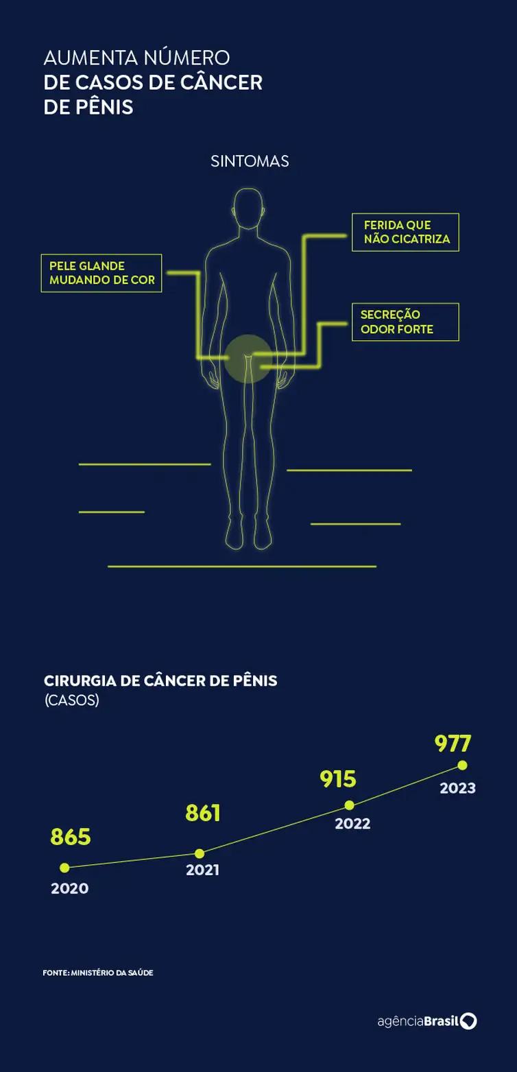 Brasil tem quase 20 mil novos diagnósticos de câncer de pênis em 9 anos