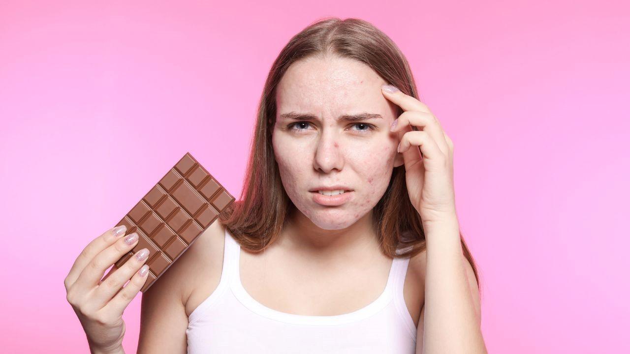 Chocolate causa acne? Saiba a verdade por trás dessa dúvida