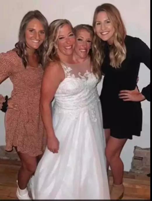 Gêmea siamesa Abby Hesel se casa e emociona o mundo