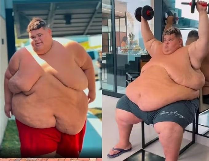 MC Ryan Gordão da XJ se prepara para cirurgia bariátrica após chegar aos 309 kg