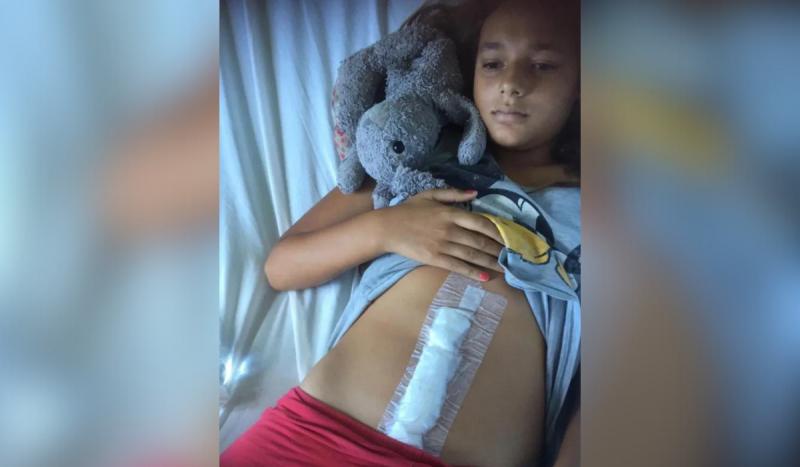 Tumor com cabelos, dentes e ossos é extraído de estômago de menina de 12 anos: ‘assustador’