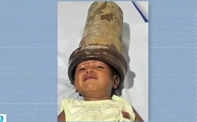 'Nasceu novamente', diz mãe de menino de 2 anos que ficou com cabeça presa em tubo de aço