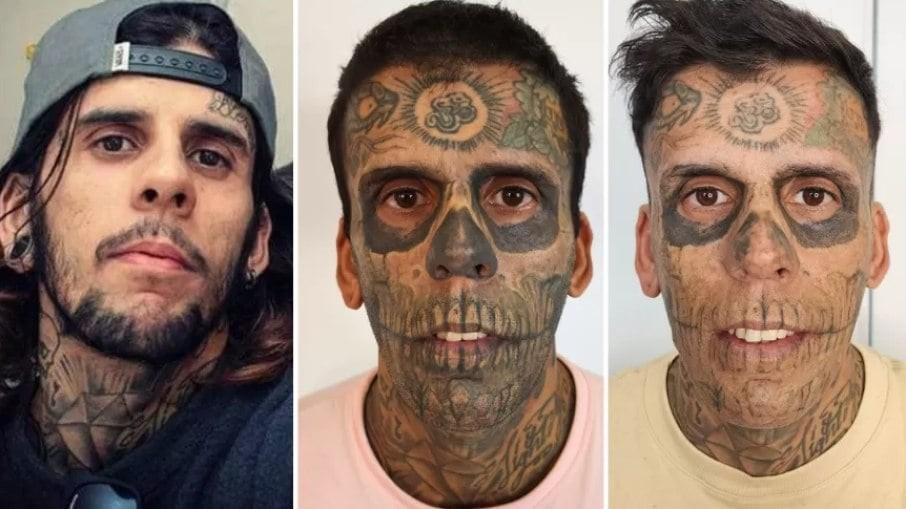 Homem mais tatuado do Brasil se converte e começa a remover tatuagens: 