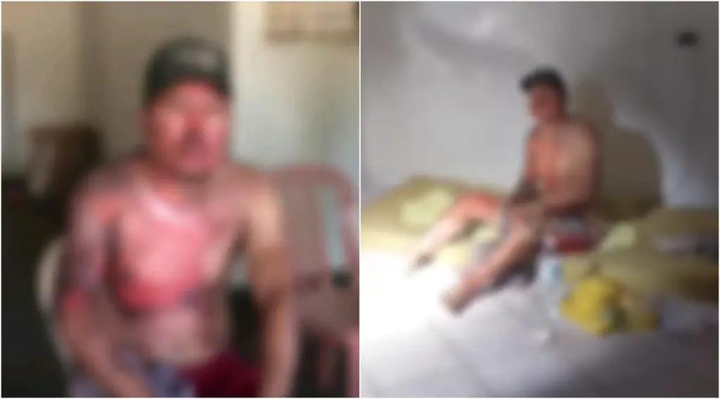 Homem é preso por atear fogo em apartamento com filhos dentro para se vingar da ex