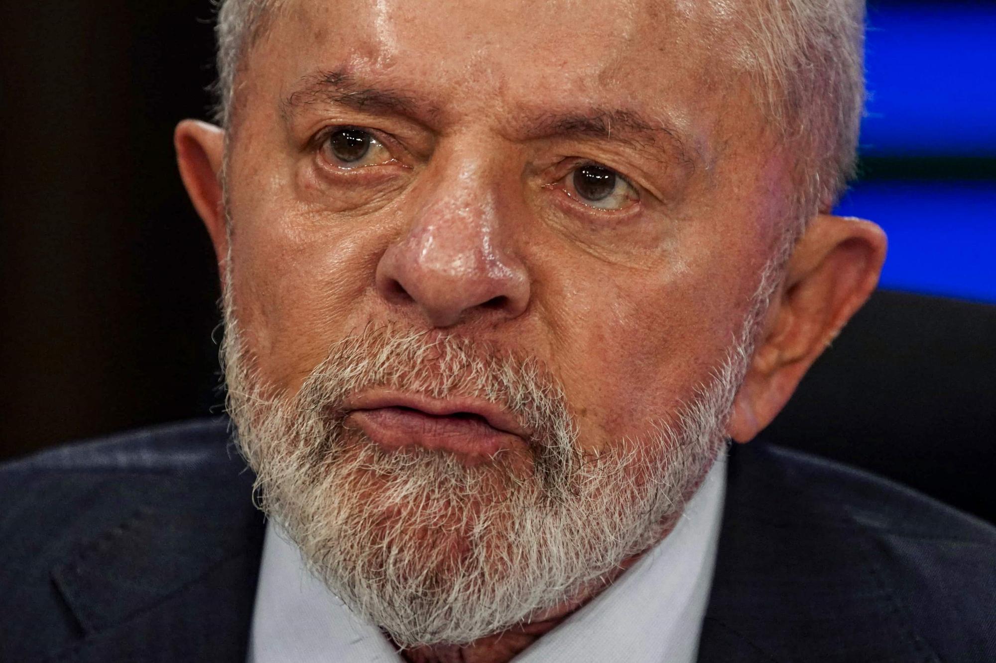 Queda de Lula em acidente foi no banheiro; presidente levou 3 pontos na cabeça