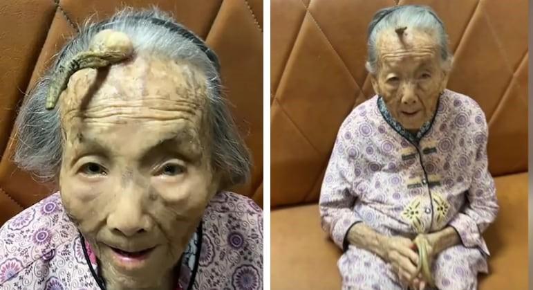 Idosa de 104 anos viraliza na internet com seu curioso ‘chifre’