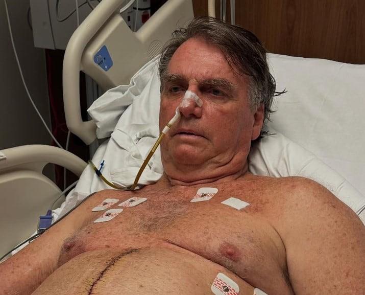 Bolsonaro apresenta piora clínica, com pressão arterial elevada, diz boletim médico