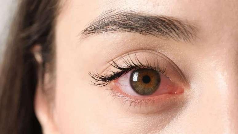 Outono: estação exige atenção com a saúde ocular