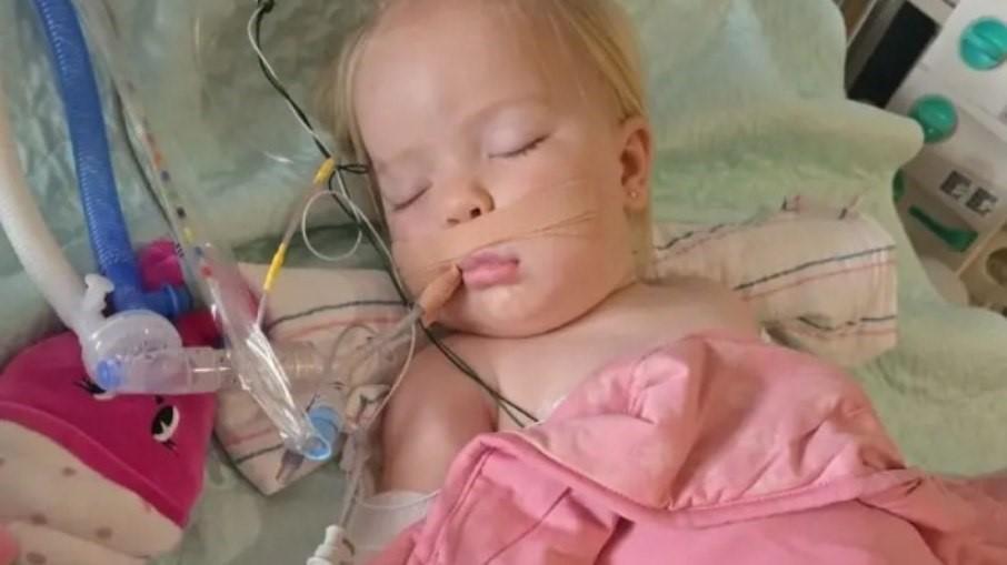 Bebê sobrevive a 2 picadas de cascavel e 30 doses de soro