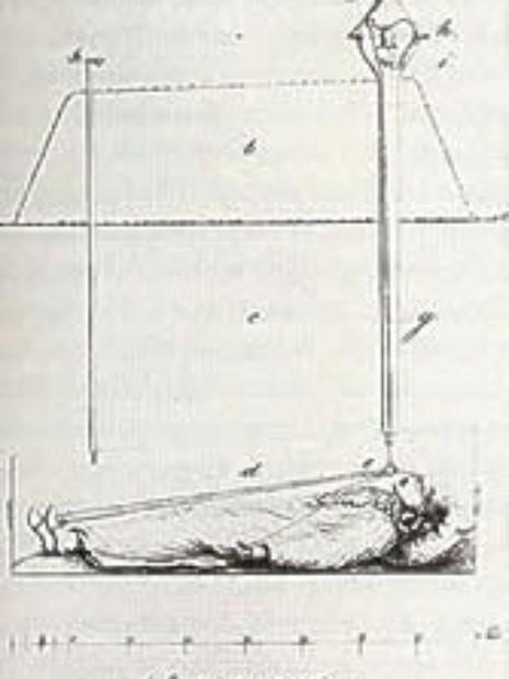 Vivos entre os mortos: a história macabra da catalepsia