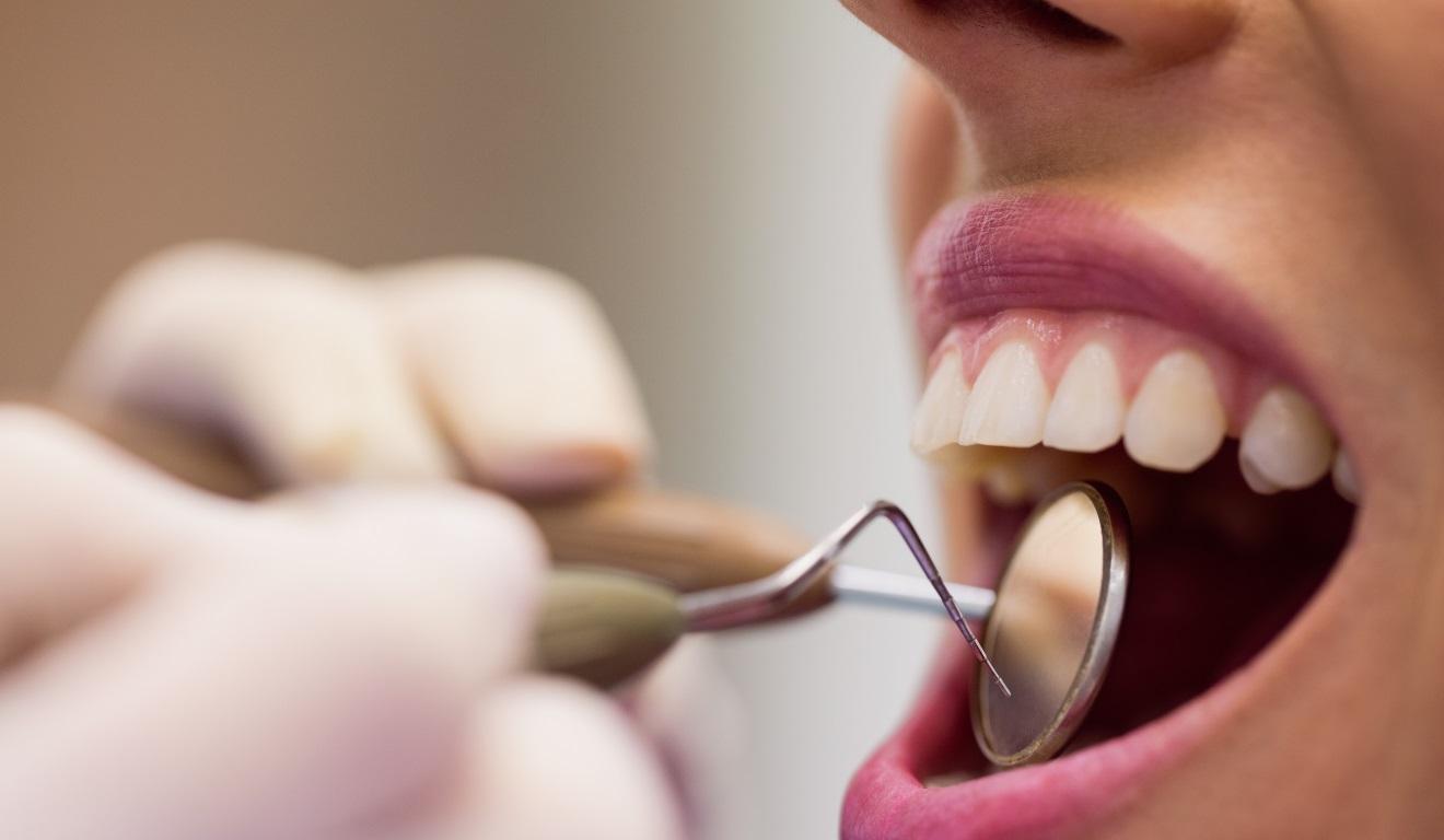 O que fazer quando o dente fica alto após a restauração?