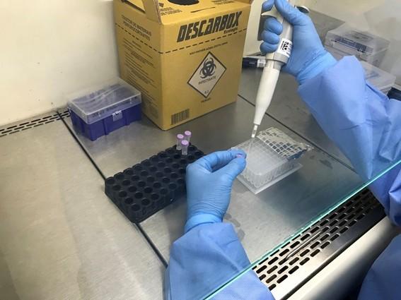 Sesa descarta Covid-19 como causa de surto no Hospital Santa Rita