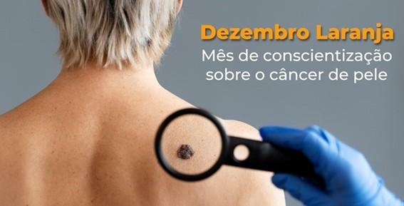 Dezembro Laranja reforça cuidados contra o câncer de pele no Espírito Santo