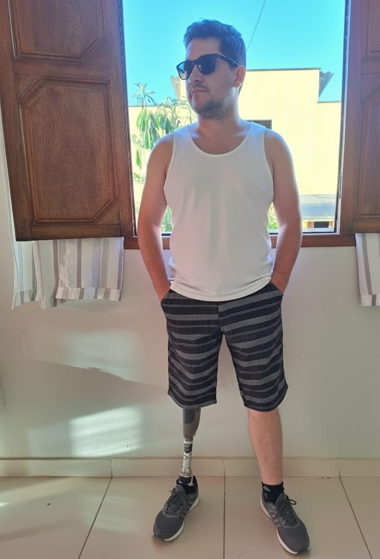 Com apoio da Suzano, eletricista retoma qualidade de vida após receber prótese de última geração