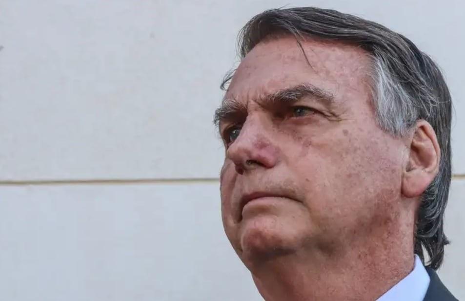 Defesa pede autorização para Bolsonaro deixar prisão e fazer cirurgia