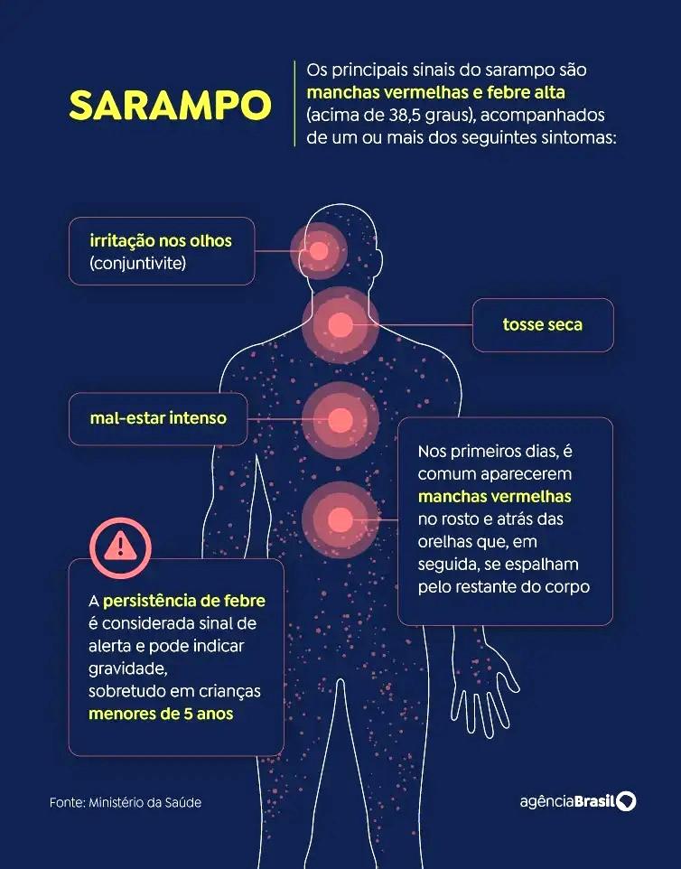Sarampo entenda sintomas, riscos e quando se vacinar