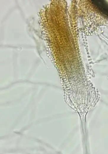 Mudanças climáticas já causam aumento de doenças infecciosas no país
