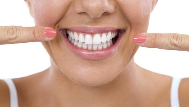Afinal, as lentes de contato dental causam mau hálito?