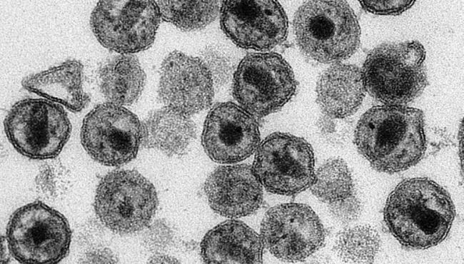 Anvisa aprova tratamento para HIV de apenas um comprimido