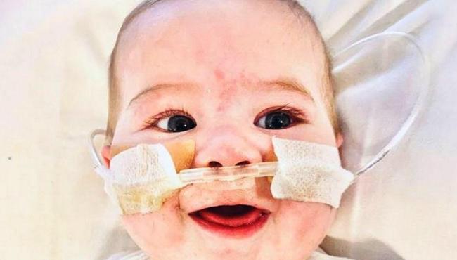 Bebê nasce com meio coração: "O outro lado não se desenvolveu", explica mãe
