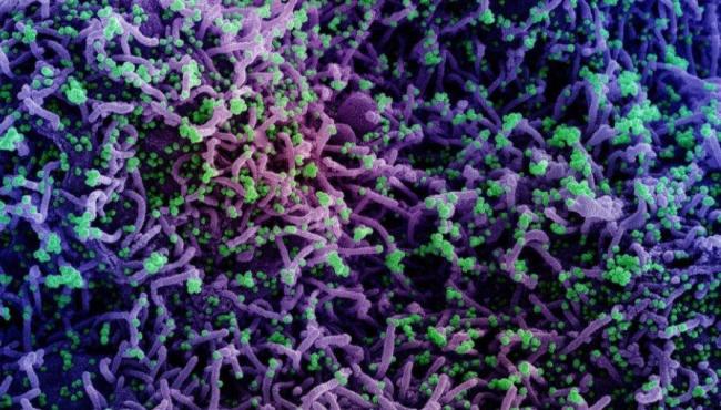 Brasil atinge marca de 23 milhões de infectados pela Covid-19