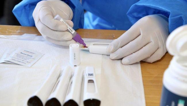 Brasil registra 112.286 casos de Covid-19 em 24 horas