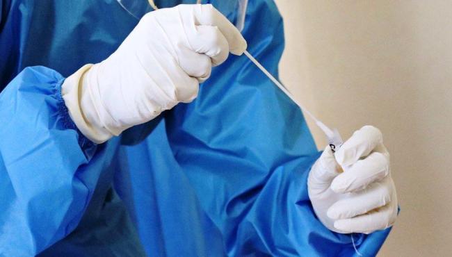 Brasil registra 140 mil novos casos e 896 mortes por Covid-19