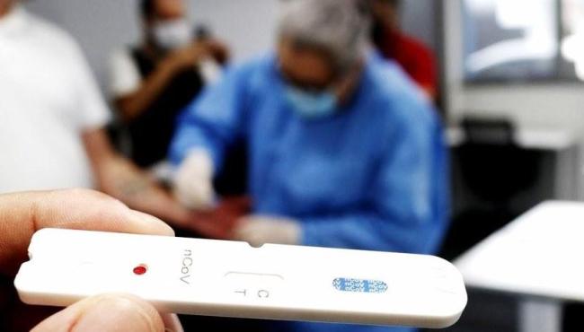 Brasil registra 143 mortes por covid-19 em 24 horas