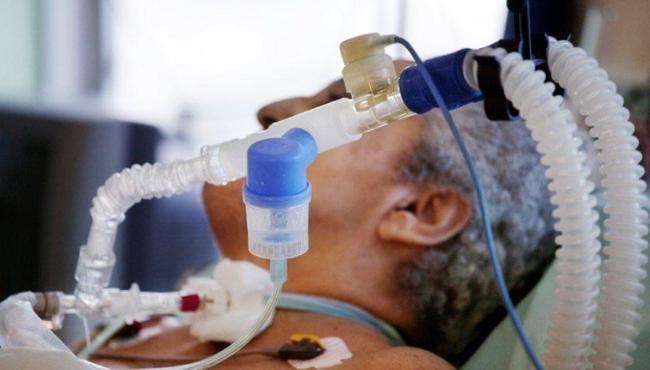 Brasil registra 176 mortes em 24 horas e tem menor média móvel desde abril de 2020