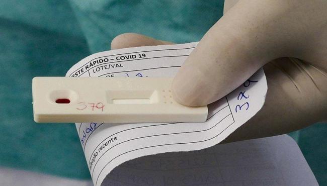 Brasil registra 34.788 casos de covid-19 em 24 horas
