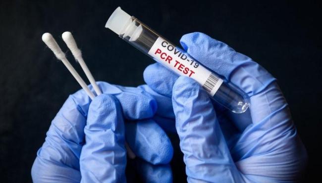 Brasil registra 60 mortes e 10 mil casos de covid-19 em 24 horas