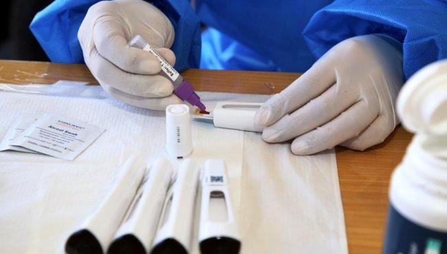 Brasil registra recorde de 137.103 casos de covid-19 em 24 horas