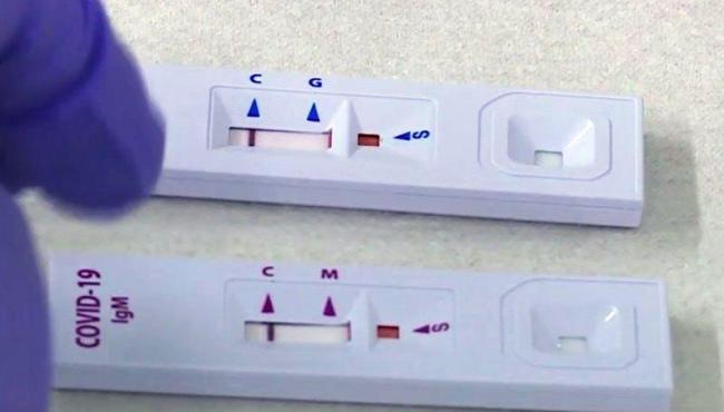 Brasil supera 15 milhões de casos de Covid-19 e 416 mil mortos