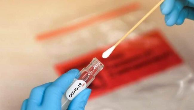 Brasil tem 105 mil novos casos de covid-19 em 24 horas