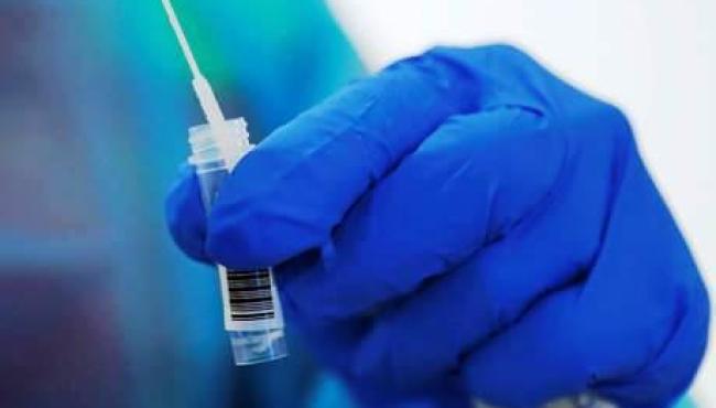 Brasil tem 173,8 mil mortes por covid e 6,38 milhões de casos