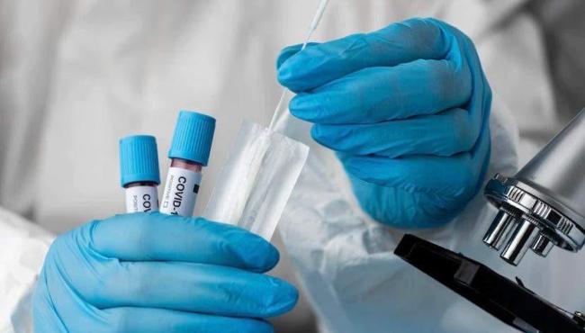 Casos de covid no ES saltam de 541 para mais de 6 mil em três meses