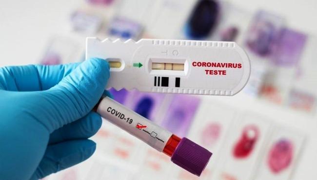 Com 19 novos infectados, Conceição da Barra vai a 6.385 casos de Covid-19