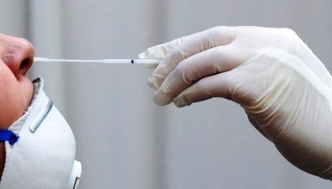 Com mais 1 infectado, Conceição da Barra chega a 6.434 casos de Covid-19