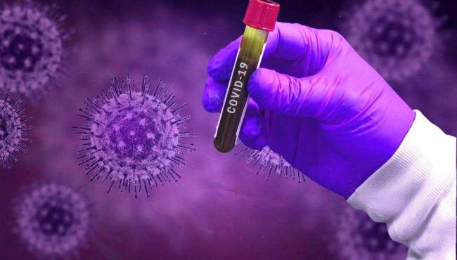 Com mais 1 infectado por Covid-19, Conceição da Barra chega a 5.660 casos confirmados
