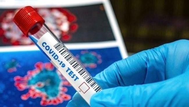 Com mais 37 infectados, Conceição da Barra vai a 2.883 casos de Covid-19