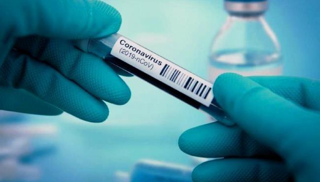 Com mais 4 infectados, Conceição da Barra chega a 5.684 casos de Covid-19