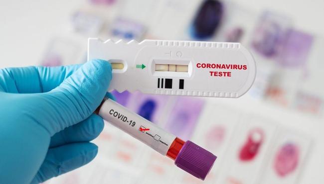 Com mais 5 infectados, Conceição da Barra vai a 5.893 casos de Covid-19